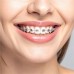 Colgate NeutraFluor 220 Daily Fluoride Mouthwash Mint 473mL Colgate NeutraFluor 220 Daily Fluoride Mouthwash Mint 473mL