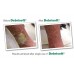 Debrisoft Debridement Monofilament Lolly Removal Of Wound Debris