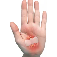 Carpal Aid alleviate the symptoms of Carpal Tunnel Syndrome 6/Box Carpal Aid alleviate the symptoms of Carpal Tunnel Syndrome 6/Box